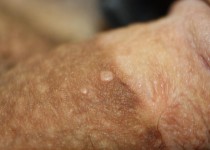 timthumbfb49